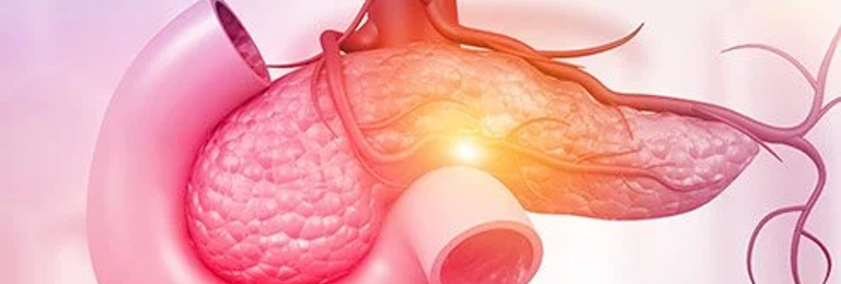 Distal Pancreatectomy